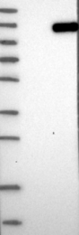 NBP1-84776 - EPHB3