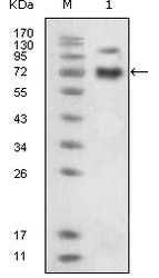 NBP1-47434 - EPHB4