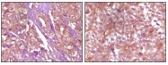 NBP1-47333 - EPHB4