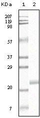 NBP1-47333 - EPHB4