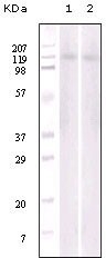 NBP1-47552 - EPHB6