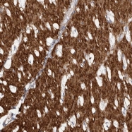 NBP1-84930 - EPRS