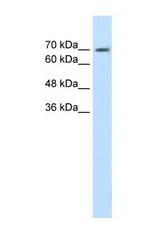 NBP1-56689 - EPS8L1
