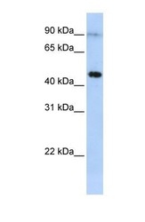 NBP1-58010 - Eosinophil peroxidase