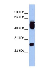 NBP1-58322 - ERAS / HRAS2