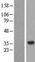 NBL1-10329 - ERGIC1 Lysate