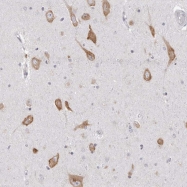 NBP1-83959 - ERGIC2