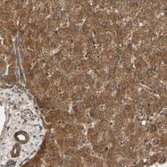 NBP1-84807 - MAPK3 / ERK1