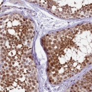 NBP1-84801 - Ermin