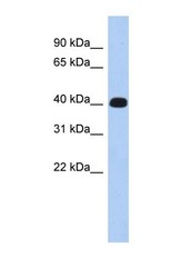 NBP1-56953 - Ermin