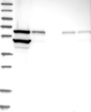 NBP1-84800 - ERO1L