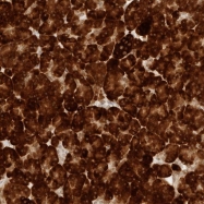 NBP1-83961 - ERO1LB