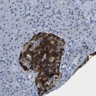 NBP1-84837 - ERVFRDE1 / HERV-FRD
