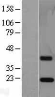 NBL1-10343 - ESM1 Lysate