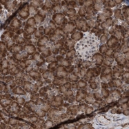 NBP1-82201 - ESRP1 / RBM35A