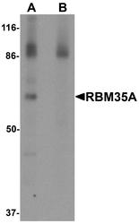 NBP1-76536 - ESRP1 / RBM35A