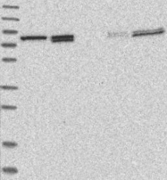 NBP1-82201 - ESRP1 / RBM35A