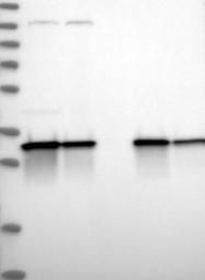 NBP1-84854 - ETFA