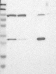 NBP1-84855 - ETFA