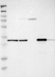 NBP1-84856 - ETFA