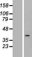 NBL1-10349 - ETFA Lysate