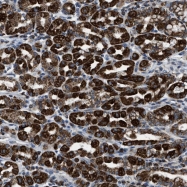 NBP1-89455 - ETFB