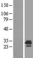 NBL1-10350 - ETFB Lysate