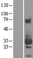 NBL1-10352 - ETHE1 Lysate
