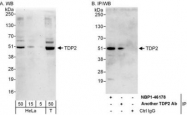 NBP1-46178 - TTRAP