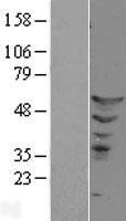 NBL1-10356 - ETS2 Lysate