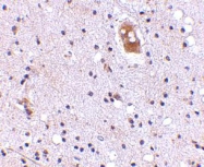 NBP1-76903 - TMC8