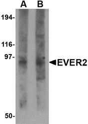 NBP1-76368 - TMC8