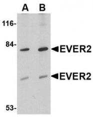 NBP1-76903 - TMC8