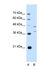 NBP1-59952 - CD361 / EVI2B