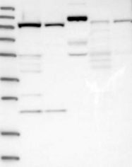 NBP1-83785 - EXOC2 / SEC5