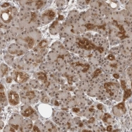 NBP1-82447 - EXOSC10