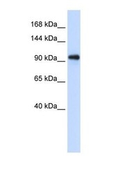 NBP1-57184 - EXOSC10
