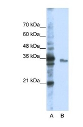 NBP1-57209 - EXOSC3