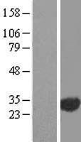 NBL1-10385 - EXOSC3 Lysate