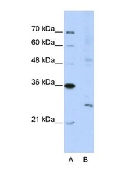 NBP1-57180 - EXOSC4
