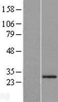 NBL1-10386 - EXOSC4 Lysate