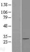 NBL1-10387 - EXOSC5 Lysate