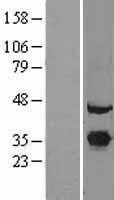 NBL1-10388 - EXOSC7 Lysate
