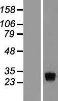 NBL1-10389 - EXOSC8 Lysate
