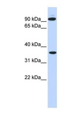 NBP1-58297 - Exostosin-2