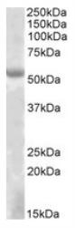 NBP1-46136 - EYA1
