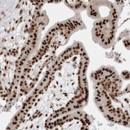 NBP1-84026 - EYA2 / EAB1