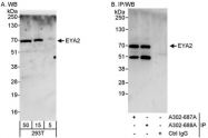 NBP1-46817 - EYA2 / EAB1