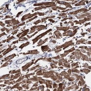 NBP1-85547 - EYA4