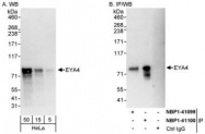 NBP1-41100 - EYA4